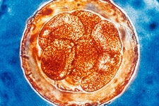 Dividing cells in a fertilized human egg. Researchers are engineering cells so that they can add distinctive bits of genetic material into their DNA so that as cells divide, each lineage builds up its own distinctive bar codes.