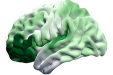 The darker green regions of the brain show the parts that have expanded the most during human evolution. A new study shows that they are the same sections that shrink the most during aging.